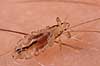 Hovedlus. Hoved lus Pediculus humanus capitis    insekter Egentlige lus, Siphunculata, ut�j, skadedyr, h�r, hovedbund, plettyfus