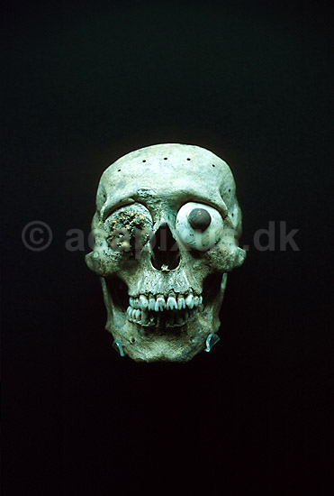 Kranium med kunstige �jne udstillet p� Museo del Templo Mayo; ; Mexico City; Mexico; Nord Amerika; ; 